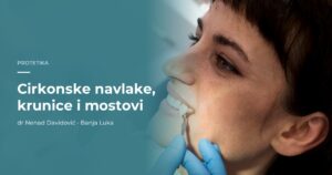 Cirkonske navlake, krunice i mostovi - protetska rje&scaron;enja, dr Nenad Davidović Banja Luka