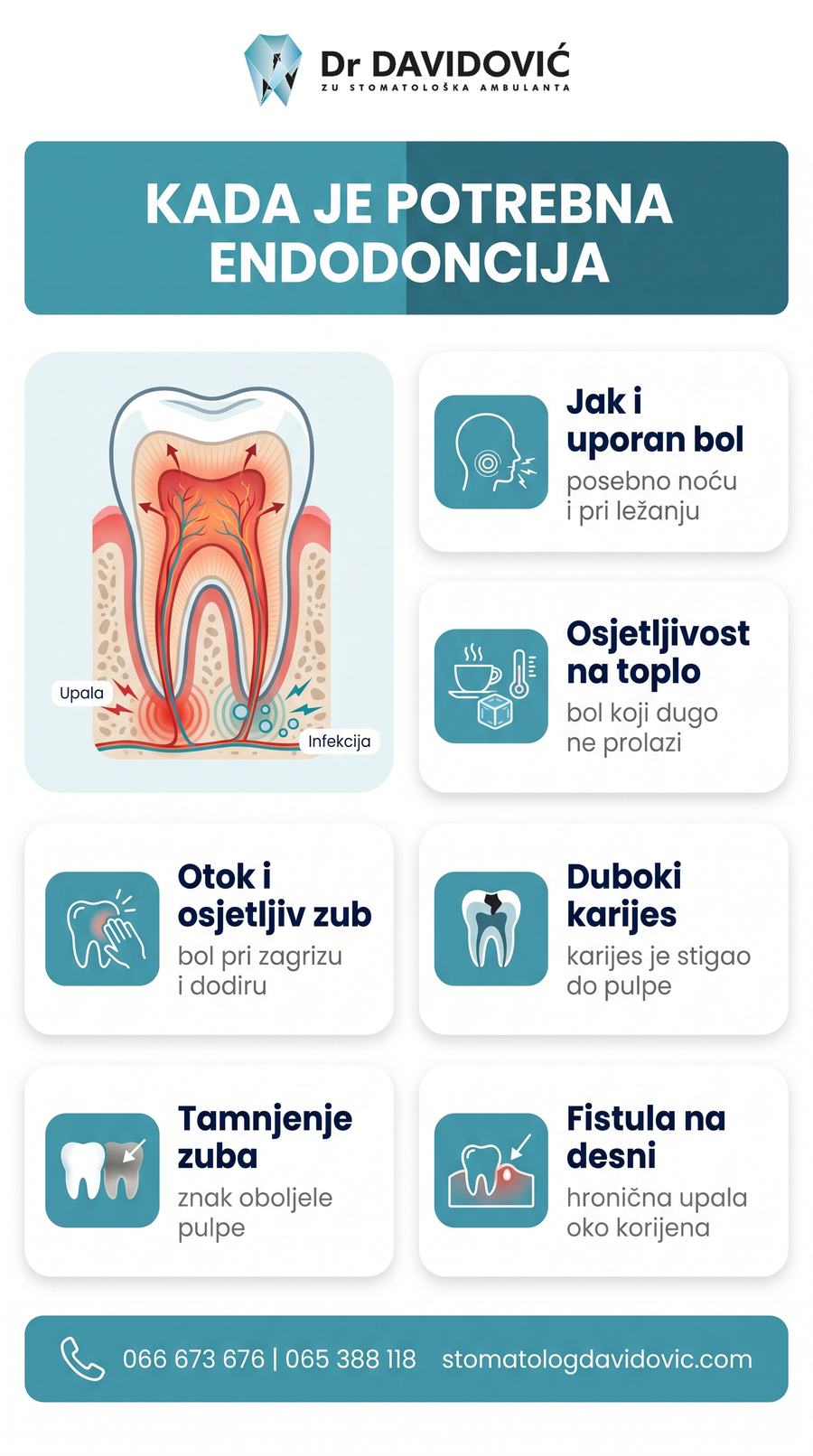 Kada je potrebna endodoncija - bol, osjetljivost, otok, duboki karijes, fistula