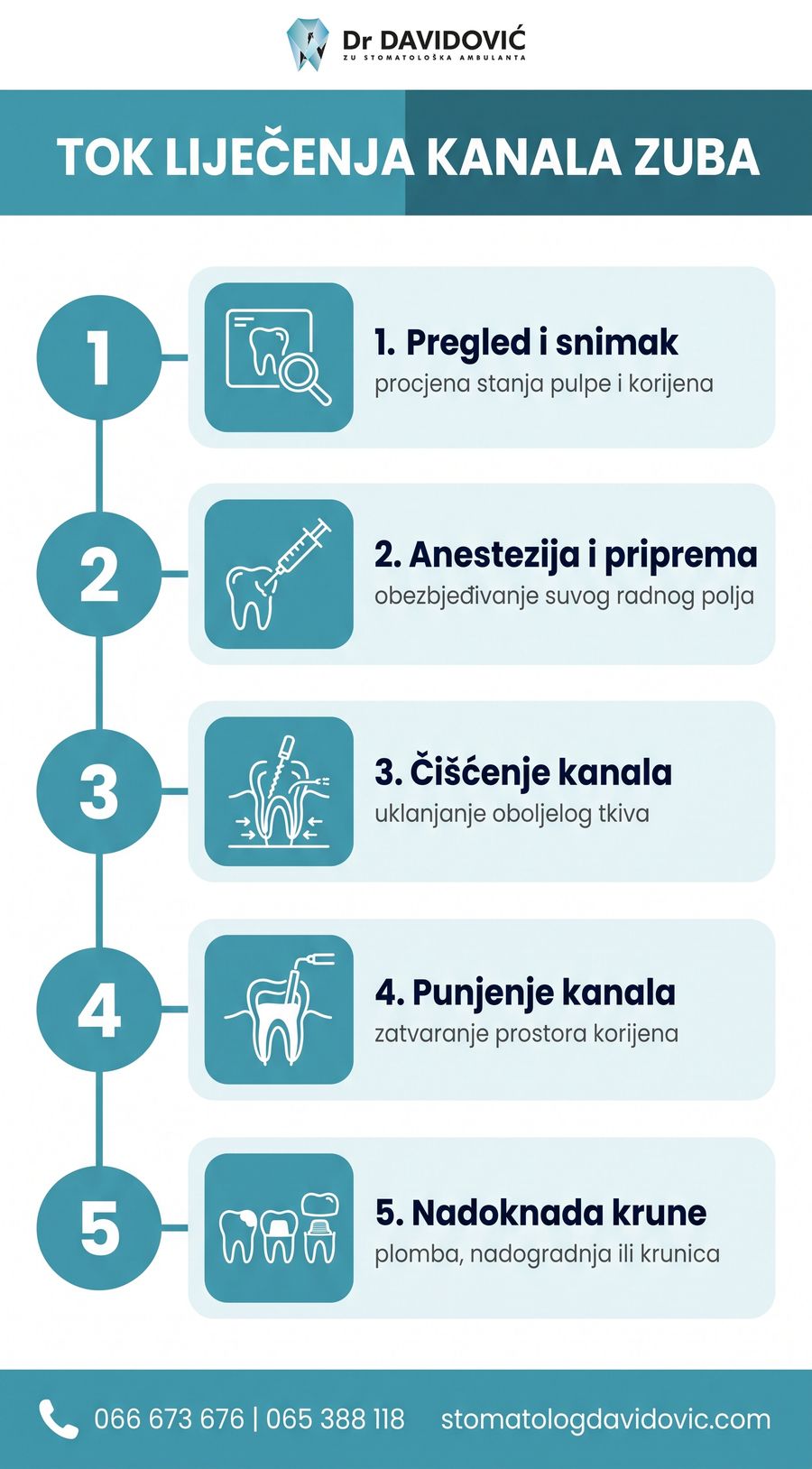Tok liječenja korijenskih kanala korak po korak