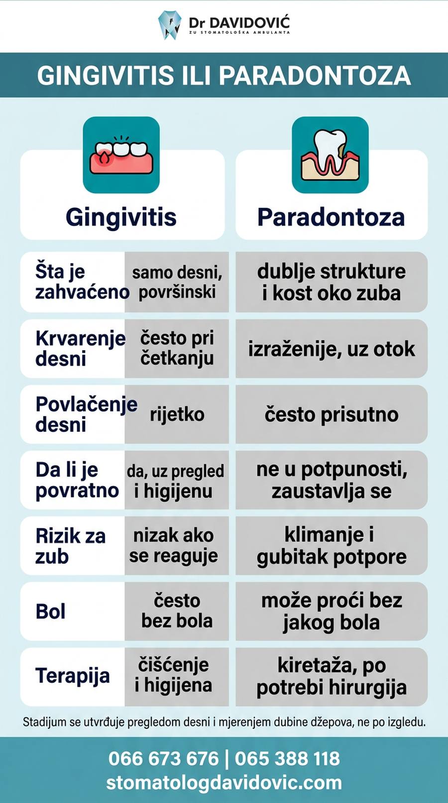 Poređenje gingivitisa i parodontoze - &scaron;ta je zahvaćeno, simptomi i rizik za zub
