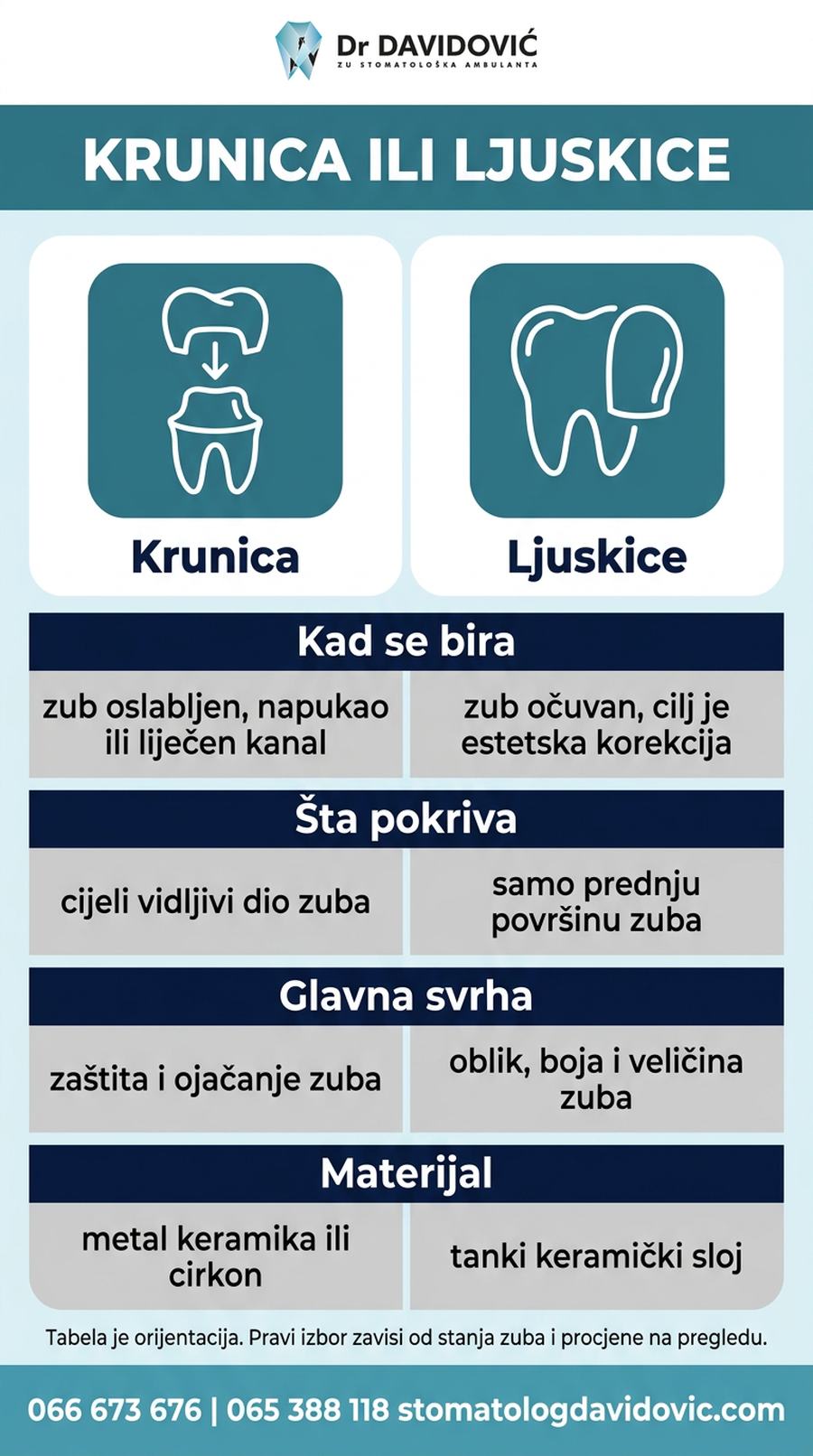Poređenje krunice i ljuskica za zube - kada se bira koja opcija