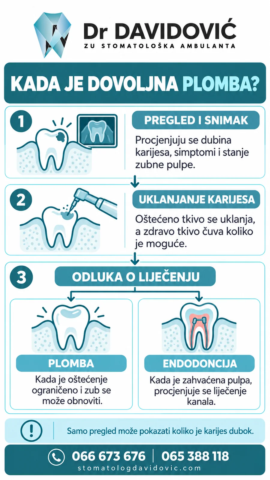 Kada je dovoljna plomba?