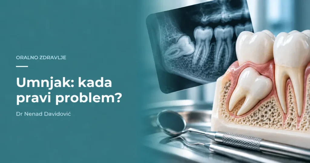 Umnjak u vilici i dentalni snimak kao ilustracija problema pri nicanju.