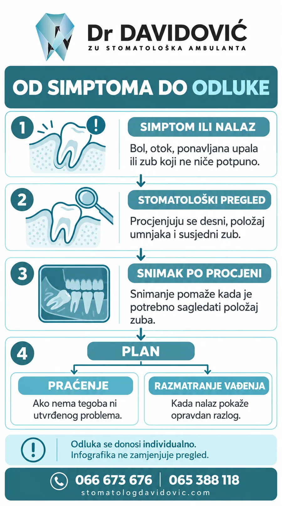 Koraci od simptoma umnjaka do pregleda i odluke o praćenju ili vađenju.